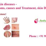 Skin diseases and conditions