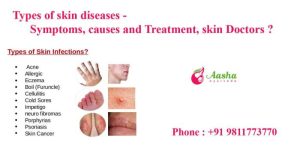 Skin diseases and conditions