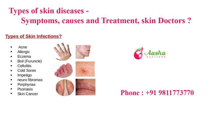 Skin diseases and conditions