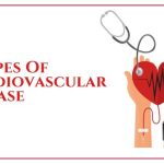 Conditions and diseases of the cardiovascular system