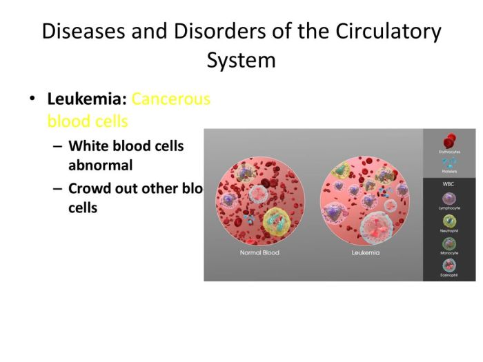 Conditions and diseases affecting the circulatory system