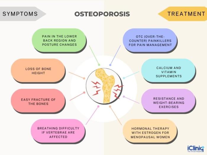 Disorders disease osteogenesis imperfecta rickets paget